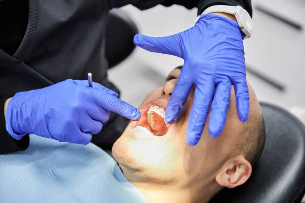 Best Emergency Tooth Extraction in Ritzville, WA