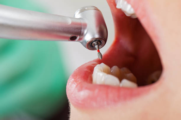 Best Cosmetic Emergency Dentistry in Ritzville, WA